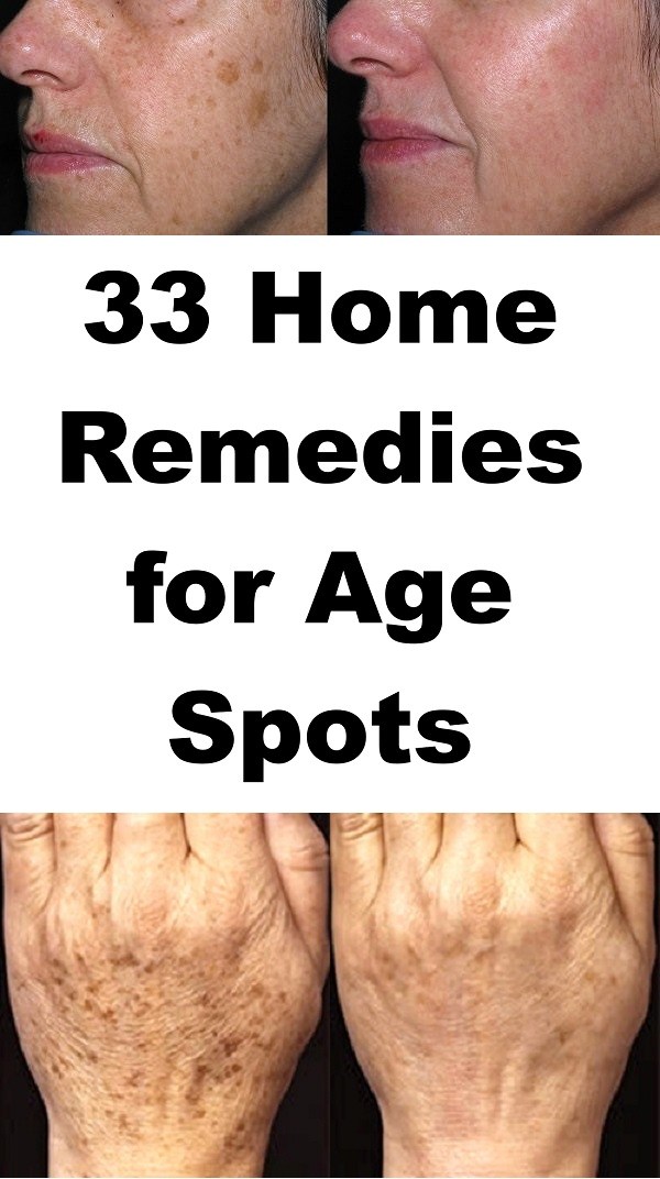 22 Home Remedies To Remove Age Spots On Your Face Hands And Legs 