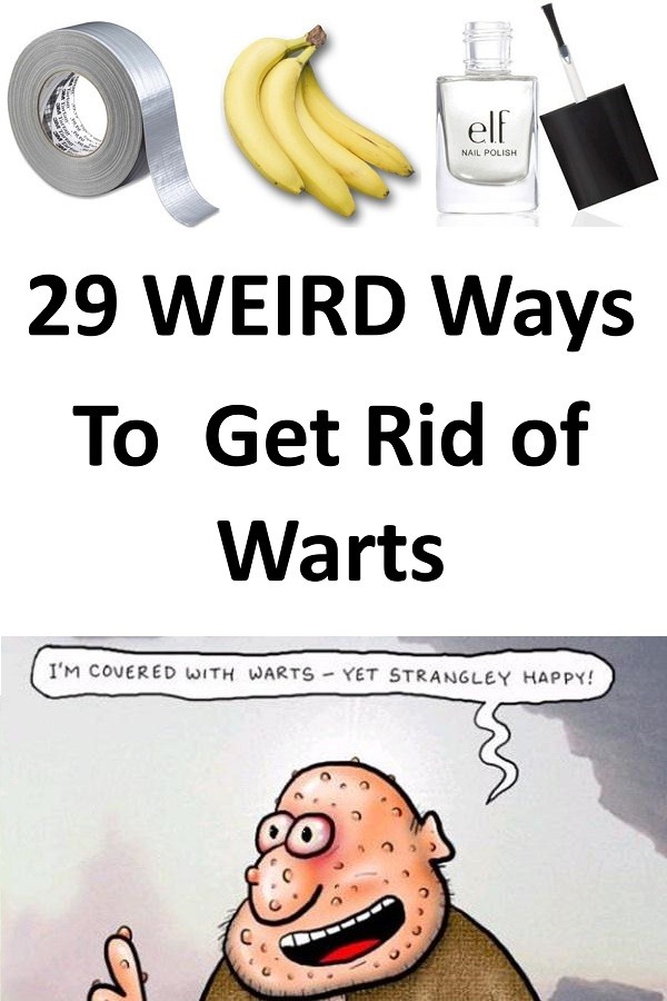 29 Ways to Get Rid of Warts Forever