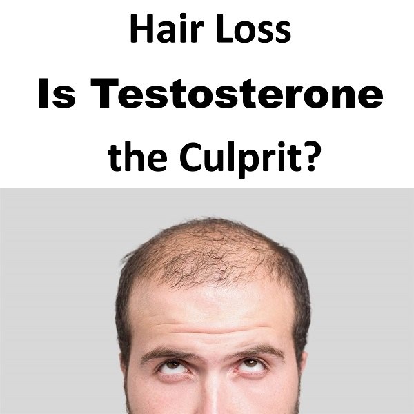 Hair Loss Is Testosterone the Culprit?