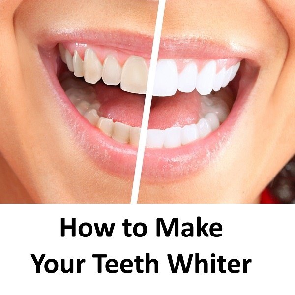 Yellow to Super White → Dental Tips to Make Your Teeth Whiter